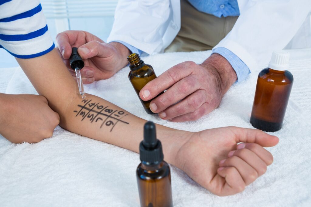 Doctor performing allergy test on skin